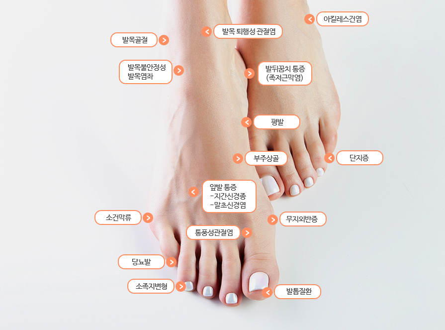 아픈 발 부위 안내도